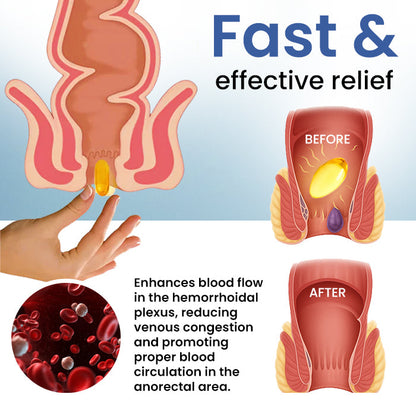 Official Store: Cvreoz® Natural Hemorrhoid Capsules - 7 Days to a Happy, Pain-Free 🍑—Guaranteed!