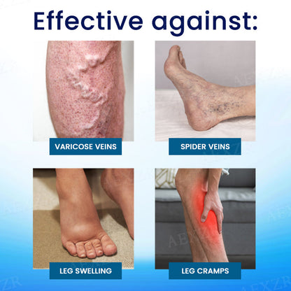 Cvreoz® Herbal Varicose Veins Treatment Spray - ✅Discount in limited time!