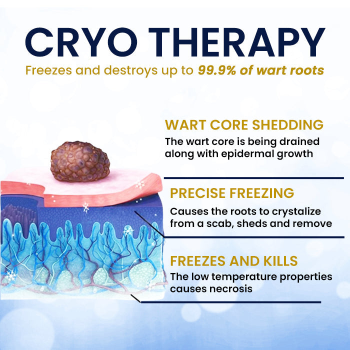 BLACK FRIDAY 40% OFF | AEXZR® Skin Tag Cryo Treatment Spray