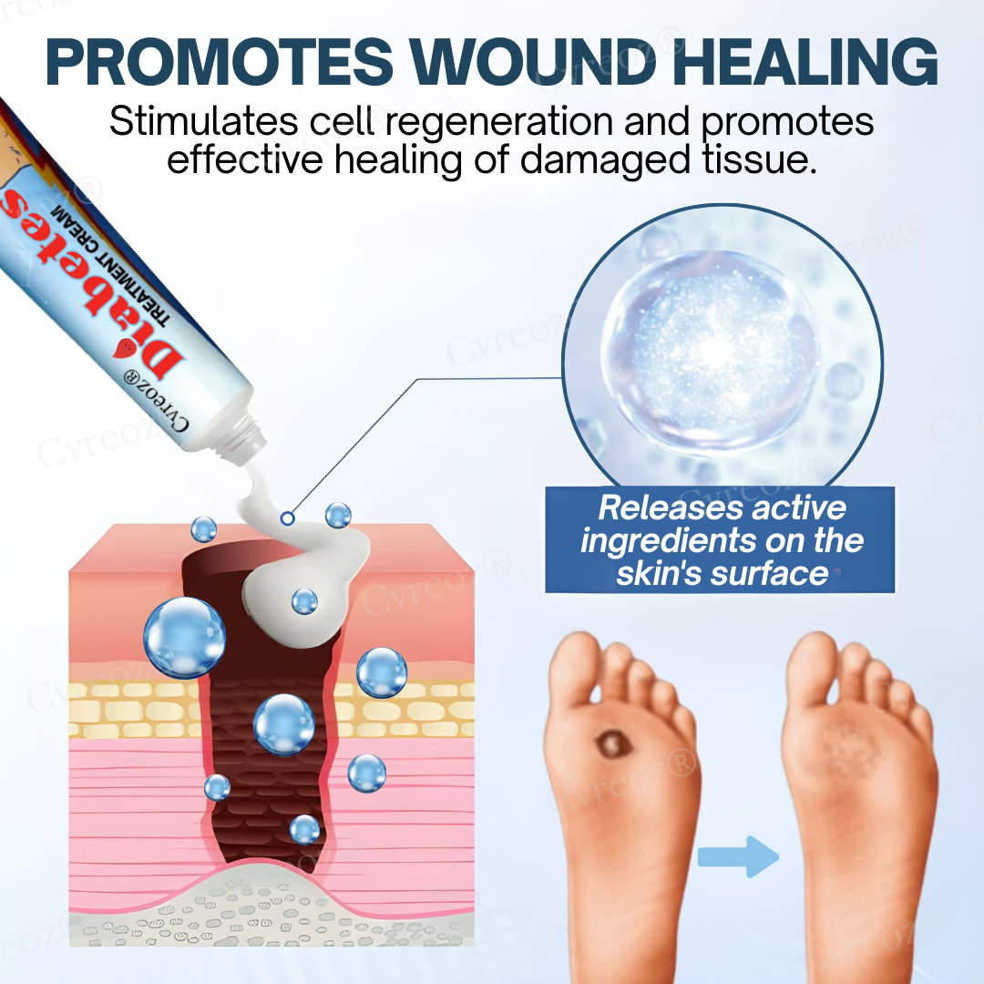 Official Store: Cvreoz® Diabetes Treatment Cream - Don't let a small wound cost you your foot—or your life！