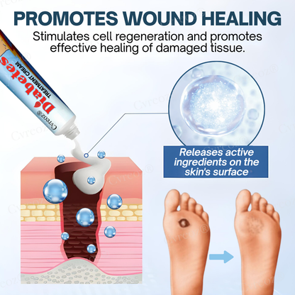 Official Store: Cvreoz® Diabetes Treatment Cream - Don't let a small wound cost you your foot—or your life！