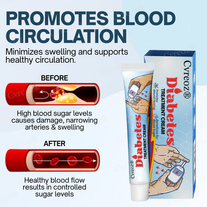 Cvreoz® Diabetes Treatment Cream