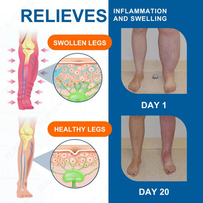 BLACK FRIDAY 40% OFF | AEXZR® LYMPHEDEMA Drainage Massage Cream