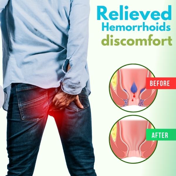 Official Store: Cvreoz® Herbal Hemorrhoid Spray -7 Days to a Happy, Pain-Free 🍑—Guaranteed!