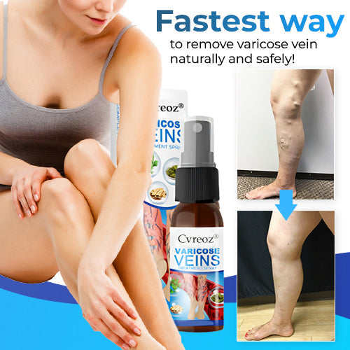 Cvreoz® Varicose Veins Treatment Spray-✅ Clinically proven to eliminate varicose veins in just 7 days!