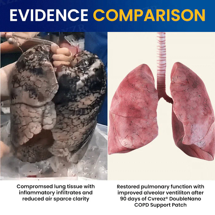 ✅🍀Official Store: Cvreoz® DoubleNano COPD Support Patch - Clinically Proven🫁 to Restore Clear Breathing in Just 7 Days!